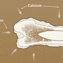 bone